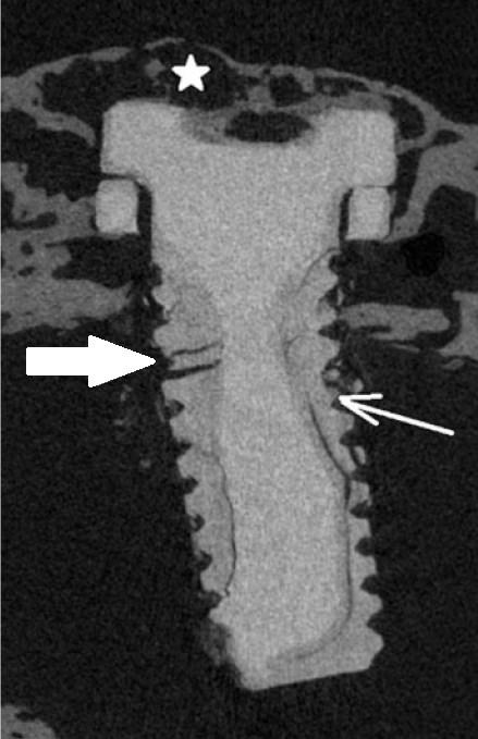 experimentálních zvířat ve stanovených časových intervalech (4, 8, 12, 16 týdnů) a po jejich zpracování hodnoceny pomocí histologie a mikro-ct.