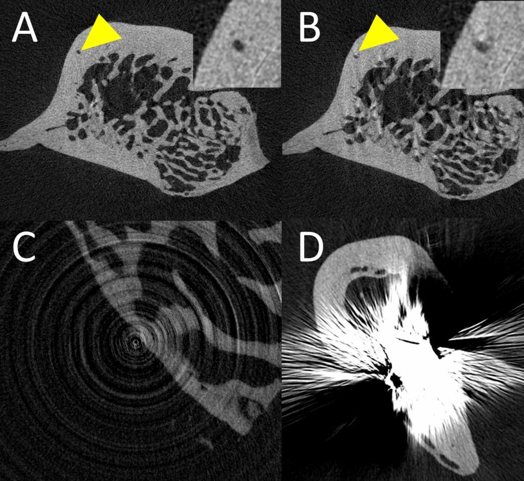 microtomography, micro-tomography, microcomputed tomography, mct, uct, µct, µ CT, µ-ct, apod.).