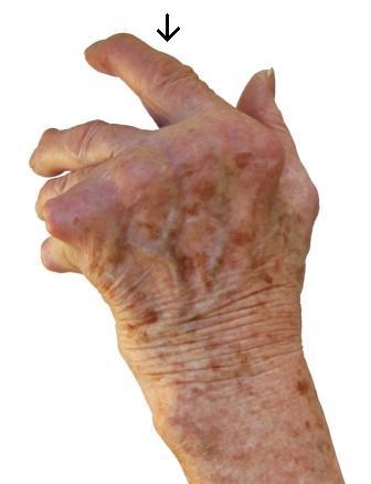 Zlepšení pohyblivosti a méně strachu o další průběh. 3.