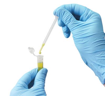 Vzorek získejte pomocí cystocentézy (doporučený postup), katétru nebo záchytu z proudu moče. 2.