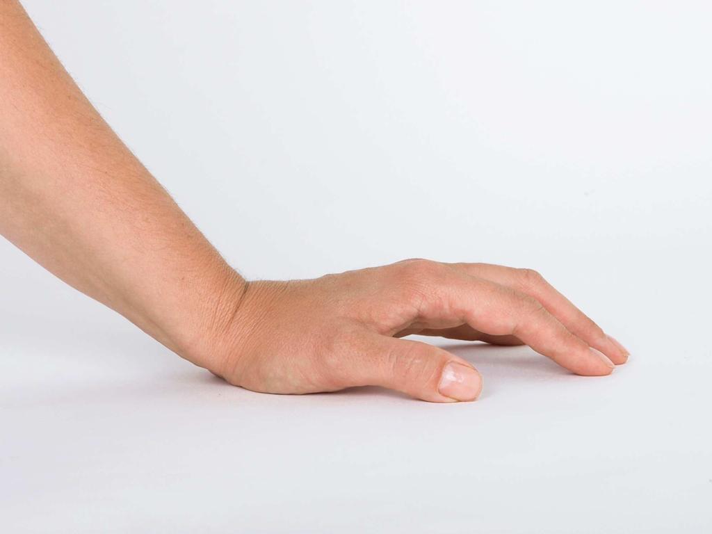 V ACT není kladen důraz na maximální dorsální flexi zápěstí, ale na kupolovité nastavení ruky a vzpěr do kořene dlaně.