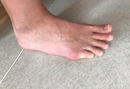 Následně po zvládnutí úchopu se pacient snaží míček předat a následně uchopit chodidlem druhé DKK. 9.