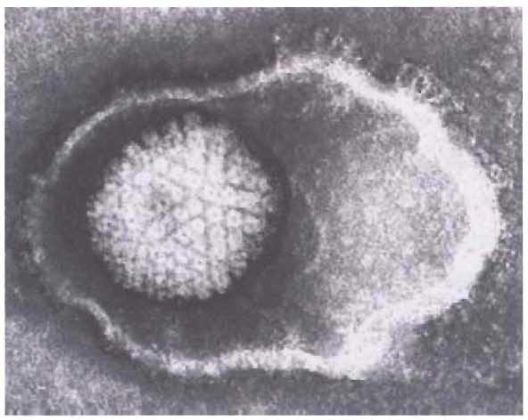 Obr. 2.7.2 Cytomegalovirus pod elektronovým mikroskopem 2.7.3 Epidemiologie a patogeneze Jediným zdrojem CMV je člověk.