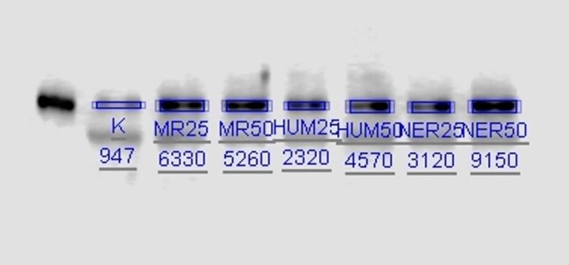 Separační gel získaný z SDS-PAGE i nitrocelulózová membrána byly vloženy na 20 min do blotovacího pufru (k 6,06 g TRIS a 28,8 g glycinu přidáno 400 ml methanolu a rozpuštěno ad 2000 ml redestilované
