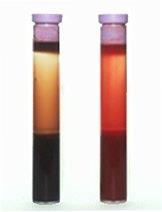 Deriváty hemoglobinu -