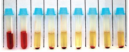 Osmotická rezistence Testování rezistence ery vůči hypotonickému prostředí specifická metoda užívající se v diferenciální diagnostice hemolytických anémii Minimální osmotická rezistence (0,4-0,44%)