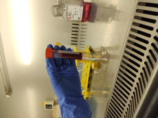 o kryo médium (40 % albumin + 40 % PBS + 20 % DMSO) Pro každý vzorek krve byly připraveny 2 zkumavky o objemu 15 ml. Do zkumavek bylo napipetováno 6 ml separačního média Ficoll-Paque.