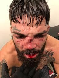 Vyšetření jednotlivých částí těla Uši, nos krvácení sekrece deformity klišťata za ušima Mike Perry - MMA