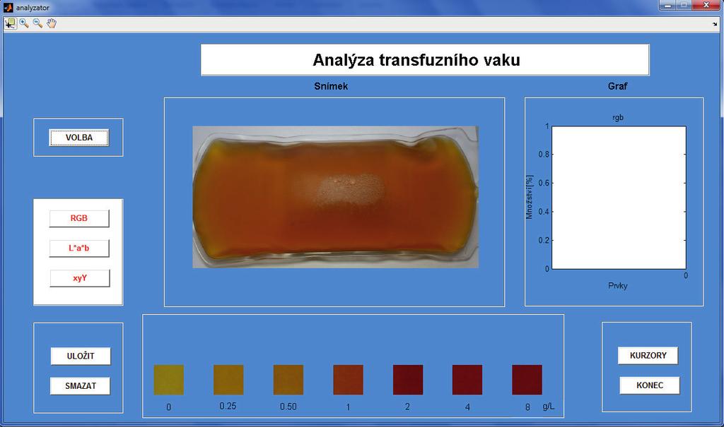 Na obrázku 6-9 je SW s načtenou fotografií a s referenčními vzorky. Na obr. 6-10 je snímek po detekci hemolýzy po použití RGB modelu.