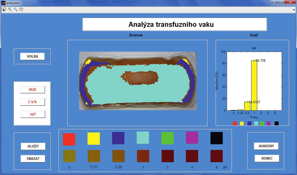 Obr. 6-10 SW pro analýzu transfuzního vaku - RGB model Na obrázku 6-11 je barva krevní plazmy rozpoznávané v barevném prostoru Lab. Na snímku je 85% barvy tyrkysové a 15% barvy modré.