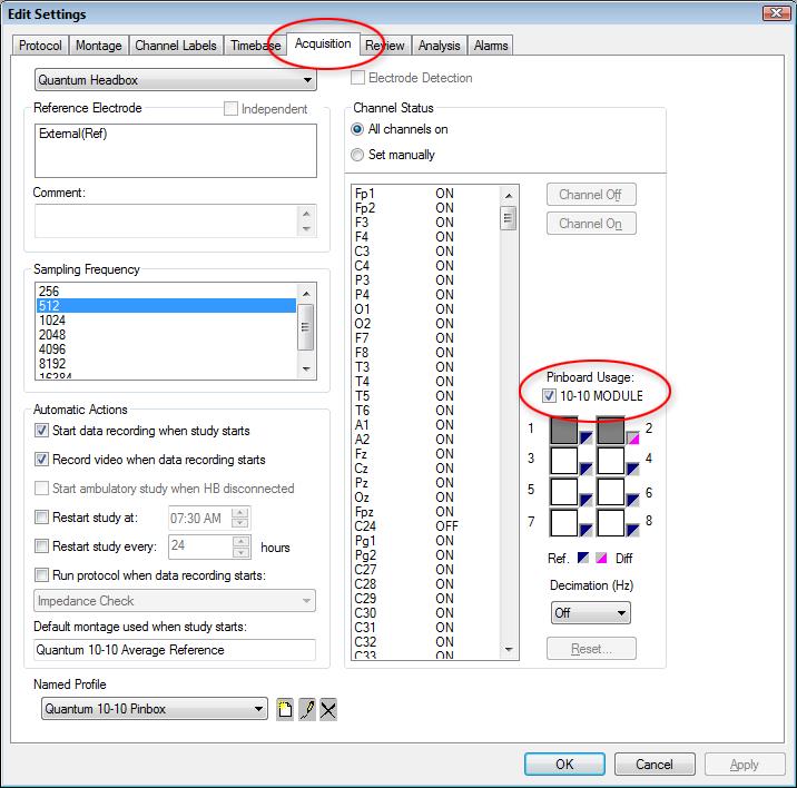 5. Aktivujte modul 10-10 pro Quantum označením zaškrtávacího políčka vedle položky 10-10 MODULE (Modul 10-10) v části Pinboard Usage (Použití kolíkové desky).