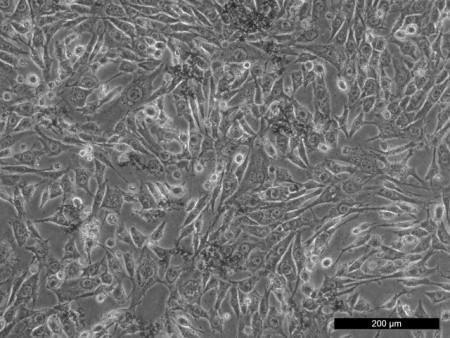 proliferace fibroblastů po 24 hodinách,