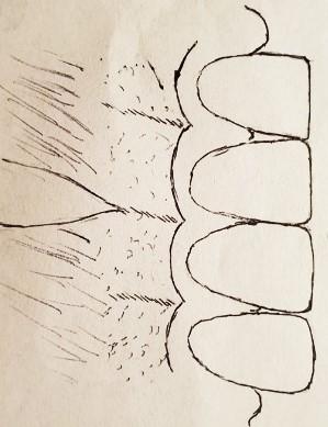 a gingivou zajišťuje periodoncium. Výše zmíněné části se řadí k závěsnému aparátu zubu neboli parodontu. 28 1.1.2.1 Gingiva Gingiva neboli dáseň je definována jako součást mastikační sliznice dutiny ústní.