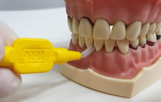 Držení mezizubního kartáčku Mezizubní kartáček se při používání uchopí mezi palec a ukazováček jedné ruky a pomocí malíčku se fixuje o bradu.