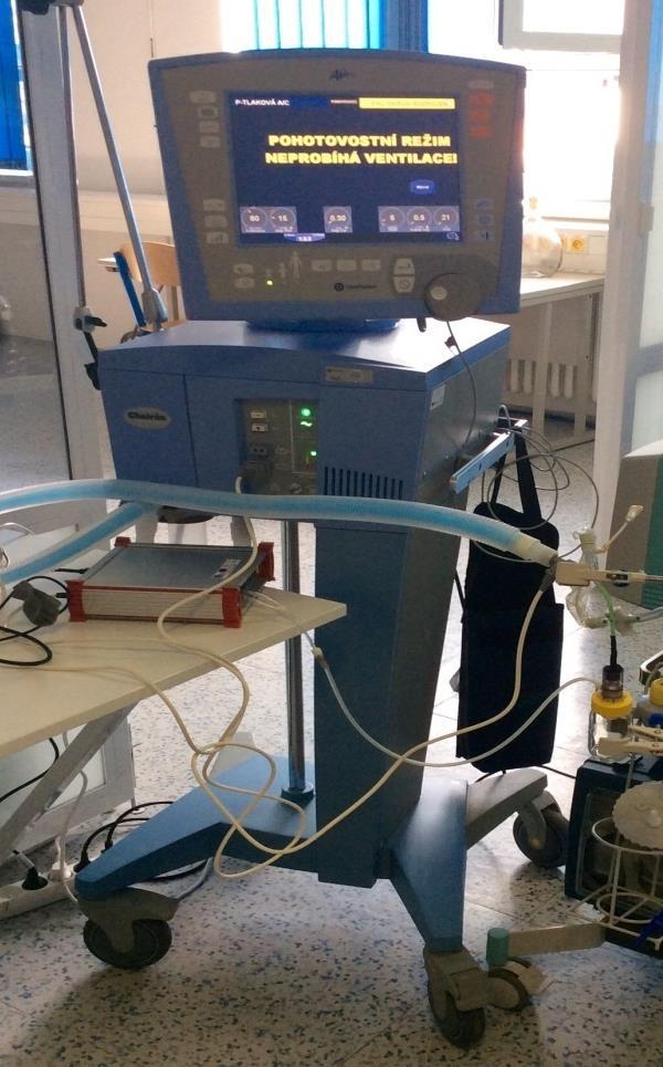 6.1 Ventilátor AVEA Ventilátor AVEA zobrazený na Obrázku 14, představuje nejvyšší model ventilátorů CareFusion určený pro ventilaci extrémně nezralých novorozenců.