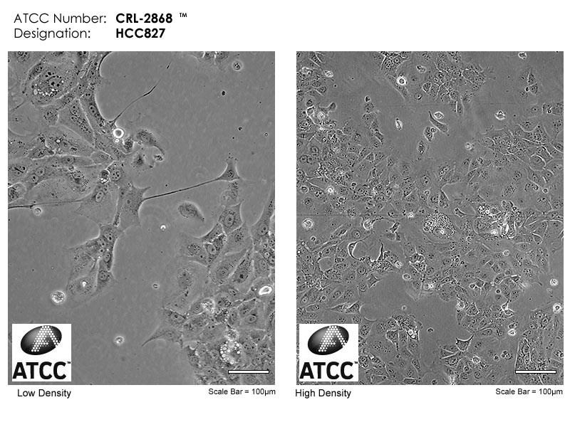 HCC827 (ATCC CRL-2868 ) Jedná se o plicní adherentní buněčnou linii, která byla získána izolací od 39leté bělošské pacientky trpící adenokarcinomem plic (ATCC HCC827 2016).