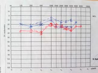 nejdříve (Jennings, 1992, Komínek, Rosoľanka in Tedla, Černý et al., 2018, Ward, Francis et al., 2012).