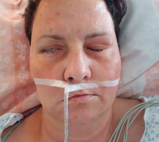 LISTY KLINICKÉ LOGOPEDIE 2/2020 40 Celá tvář Celá tvář V klidu Pohyb čelo Pohyb oči Pohyb ústa Celá tvář V klidu Pohyb čelo Pohyb oči Pohyb ústa Celá tvář V klidu Pohyb čelo Pohyb oči Pohyb ústa Celá