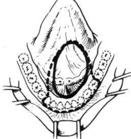 přístup s
