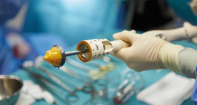 Technika TST minimalizuje pooperační komplikace u hemoroidů Tissue selecting therapy (TST) spojuje výhody klasické hemoroidektomie a staplerové techniky a v současnosti je asi nejprogresivnější
