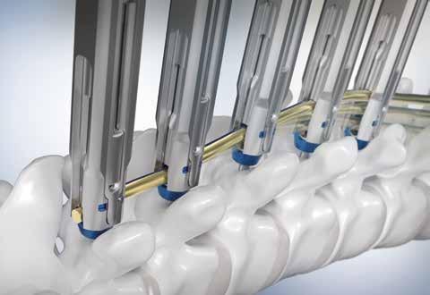 Obsah 6 Unikátní operace ucha pomocí digitálního 3D mikroskopu AEOS 8 Rozhovor: Kloub