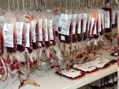 2. HEMATOLOGICKÉ VYŠETŘENÍ PROVÁDÍ HEMATOLOGICKÁ LABORATOŘ - OKH KREVNÍ OBRAZ RBC - ERYTROCYTY, WBC - LEUKOCYTY, PLT - TROMBOCYTY, HB - HEMOGLOBIN, HCT - HGEMATOKRIT KREVNÍ OBRAZ + DIFF.