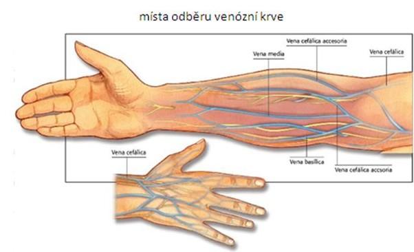 VHODNÁ MÍSTA K ODBĚRU KRVE VÉNY V TEMENNÍ A TEMPORÁLNÍ OBLASTI (U