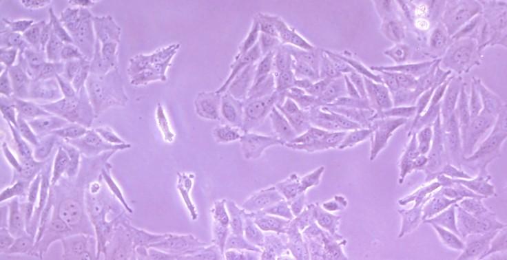 8.3 Použitý buněčný model Pro testování adheze, proliferace a diferenciace kostních buněk na materiálech in vitro byla zvolena buněčná linie Saos-2 (ATCC-HTB-85, Chemos).
