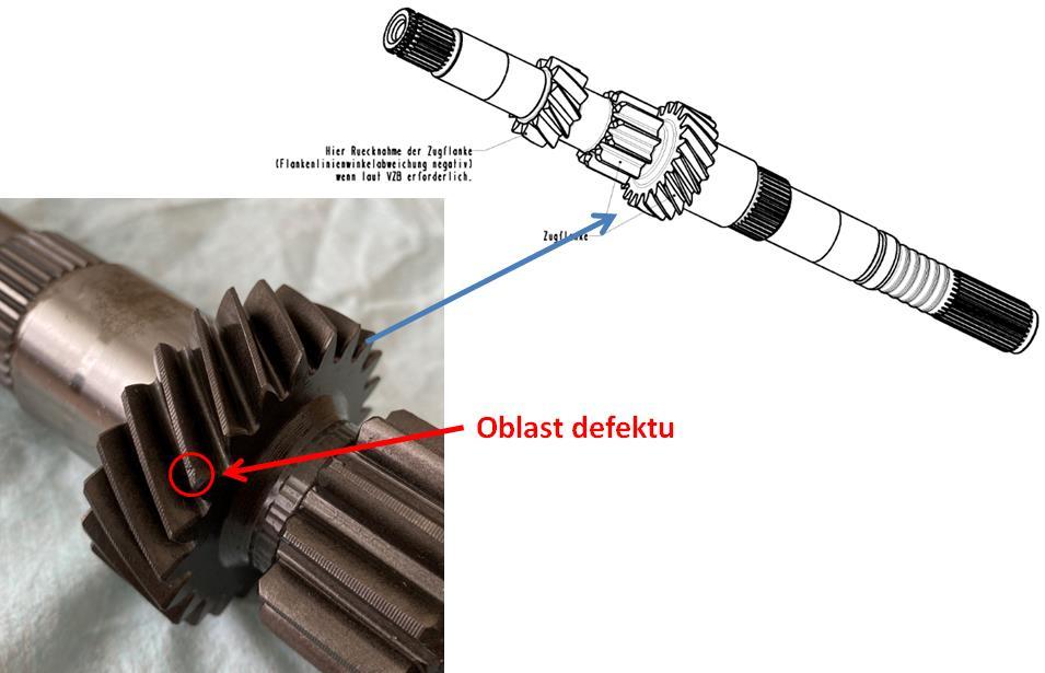 Defekt, který nás zajímá, se nachází na vrcholu zubu a částečně přechází a zasahuje přes hranu až do hlavové části boku zubu.