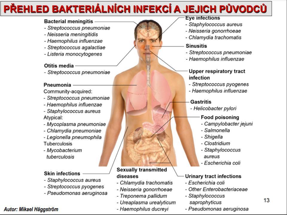 5 Přehled bakteriálních infekcí a jejich původců Zdroj: