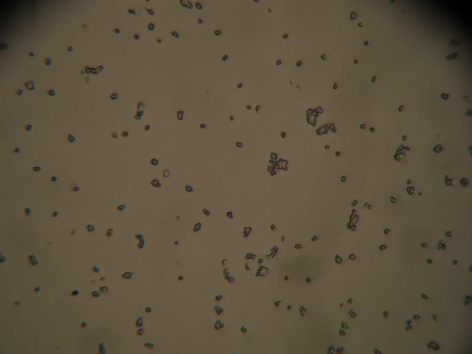 33 a 34: Snímek bakterií Staphylococcus aureus