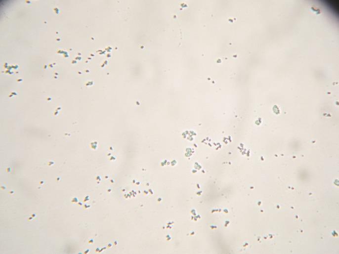 Vliv nanočástic stříbra na testované bakterie byl následně pozorován v závislosti na čase po dobu 1, 2 a 3 hodin.