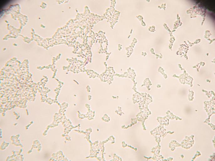 43 a 44: Snímek bakterií Staphylococcus aureus z fluorescenčního