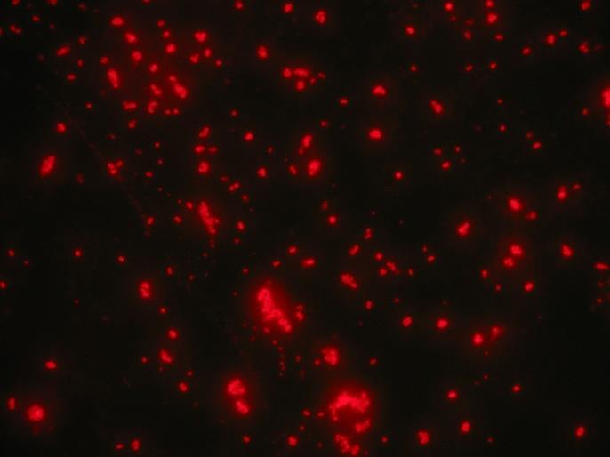 57 a 58: Snímek bakterií Staphylococcus aureus