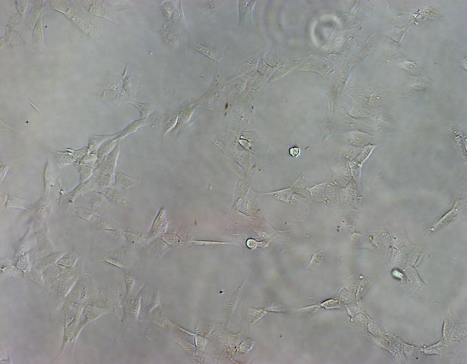 78 a 79: Snímky fibroblastů po 6 hodinách inkubace se vzorkem Ag-RBITC-II.