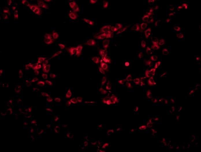 Po 24hodinové inkubaci fibroblasty vykazovaly fluorescenci, která byla pozorovatelná v jejich cytosolu