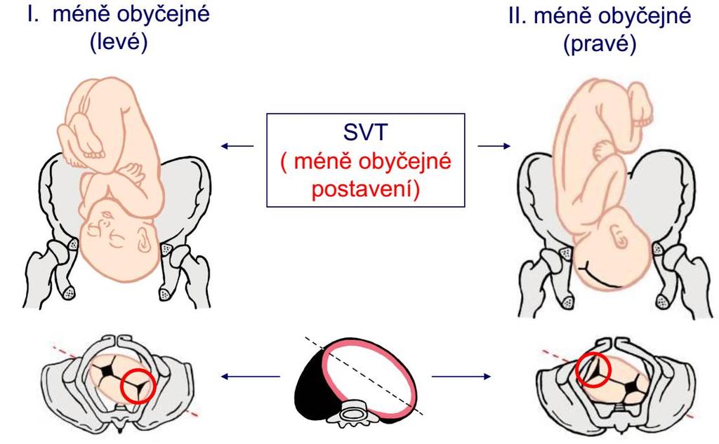 Postavení u
