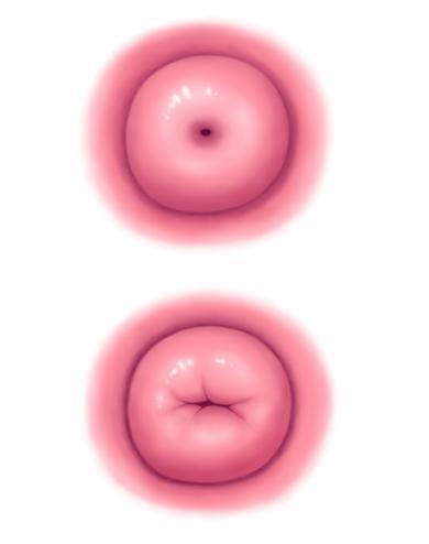 Vaginální vyšetření Pomalu, v klidu, oznámit za jakým účelem, s gelem!