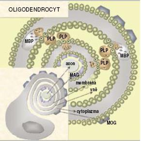 Etiopatogeneze Autoimunitní odpověď začnou útočit- přímo proti CNS antigenům (MBG, MAP, MOG) a