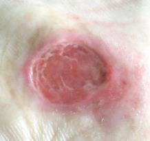 červenofialové, mokvavá plocha (klinicky: odřenina, puchýř, mělčí kráter).