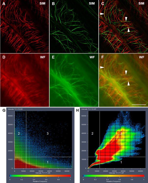 Fig. 11. Colocalization of actin microfilaments and microtubules in hypocotyl epidermal cells of Arabidopsis thaliana stably expressing a fabd2-gfp actin marker and a TUA5-mCherry microtubule marker.