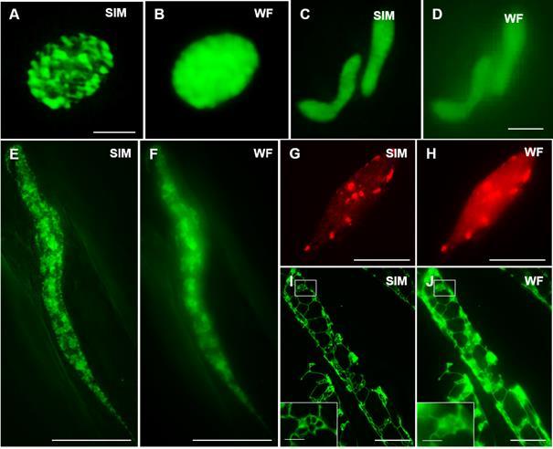 Fig. 12. Structured illumination microscopy can deliver superresolved images of various plant organelles as compared to widefield epifluorescence imaging. A,B plastids. C,D mitochondria.