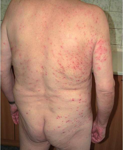 Dermatovenerologické kliniky 1.