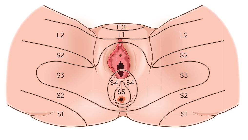 a protažitelnost jizev po epiziotomii (Havlíčková, 2017). Vyšetření svalů pánevního dna per vaginam bylo poprvé popsáno Arnoldem Kegelem jako metoda z zhodnocení funkce svalů.