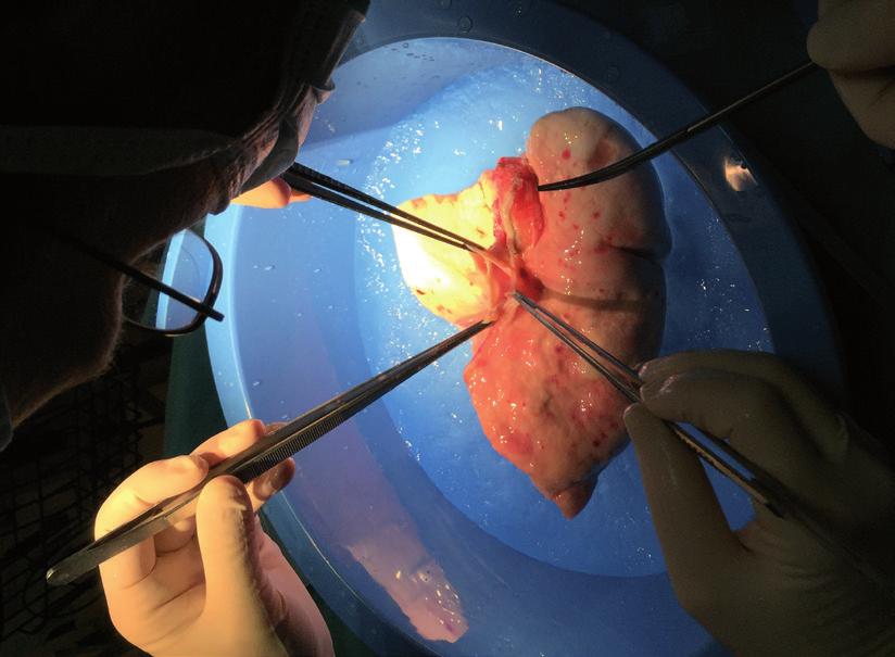 transplantaci plic 100 80 přežití (%) 60 40
