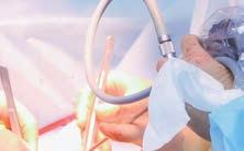 kliniky patří chirurgie jícnu a