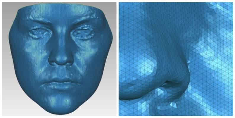 1.7 OBECNÝ KONCEPT 3D ZOBRAZENÍ 3D morfometrie je přesné nezkreslené prostorové zobrazení anatomických struktur, např. obličeje pacienta.