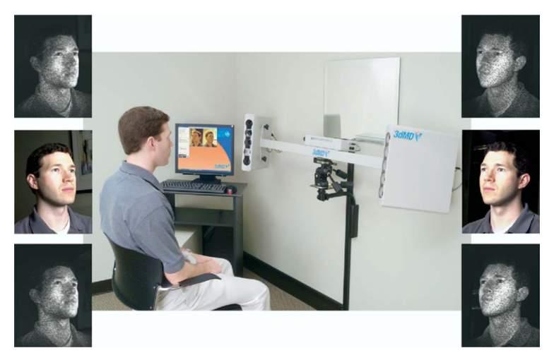Obr. 24 3D stereofotogrammetrický skener 3dMD Face System. Skener je tvořen 6 kamerami umístěnými ve 2 snímacích jednotkách, které jsou synchronizovány.