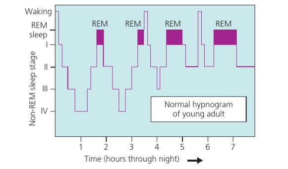 Obr. 3 Hypnogram zdravého mladého člověka (Reading, 2013) 1.3 Spánek v průběhu života Naše spánkové vzory mají též tendenci se měnit s věkem.