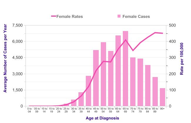 Incidence karcinomu prsu dle věku Breast Cancer (C50): 2011-2013 Average Number of New Cases Per Year and Age-Specific Incidence Rates per 100,000 Population, Females, UK Source: cruk.